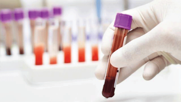Blood Tests.