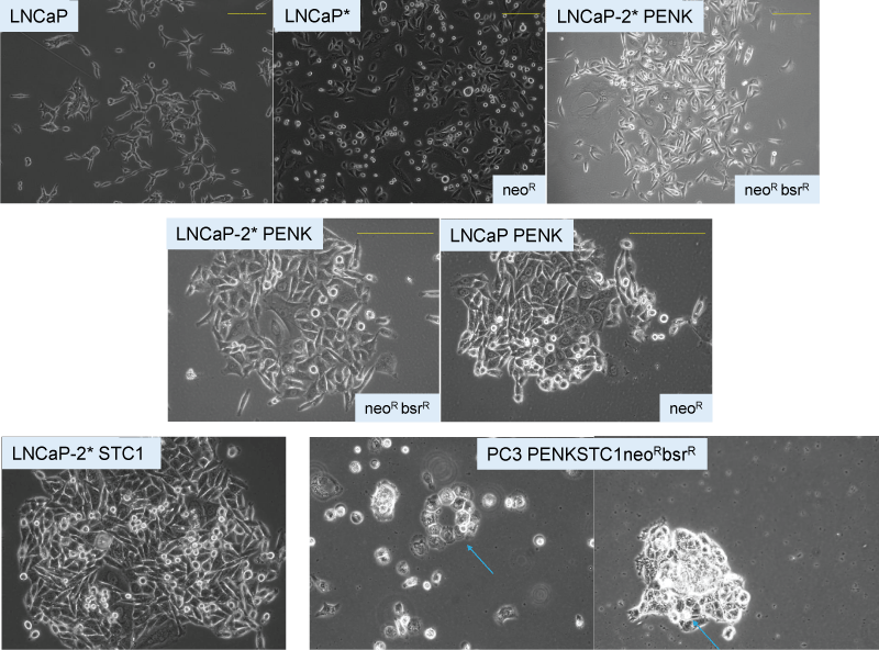 Prostate cancer cell dedifferentiation and differentiation. The top five panels show LNCaP, LNCaP+scTF=LNCaP*, LNCaP*+PENK. Gene expression changes as monitored by transcriptome analysis are accompanied by changes in cell appearance. The bottom three panels show luminal-like LNCaP transfected by STC1 and the more stem-like PC3 by PENK and STC1 expression plasmids. Gland-like cell clusters (blue arrows) with a central lumen can be seen in PC3/PENKSTC1. neoR and bsrR indicate drug resistance in the selection of transfected cells.